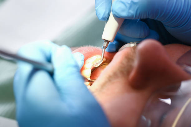 Best Cosmetic Emergency Dentistry in Lynchburg, OH