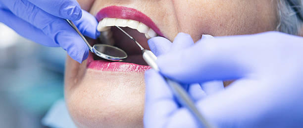 Best Emergency Tooth Extraction in Lynchburg, OH